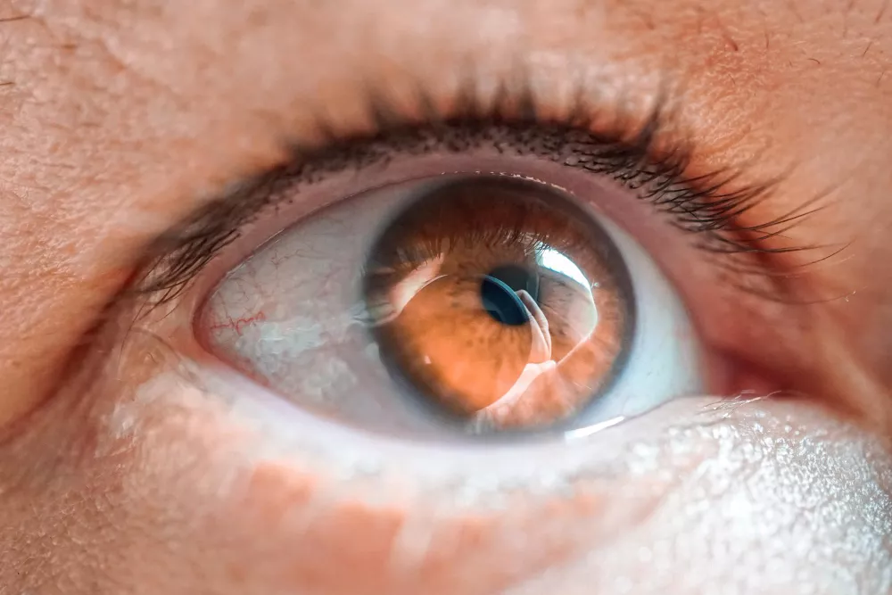 cornea